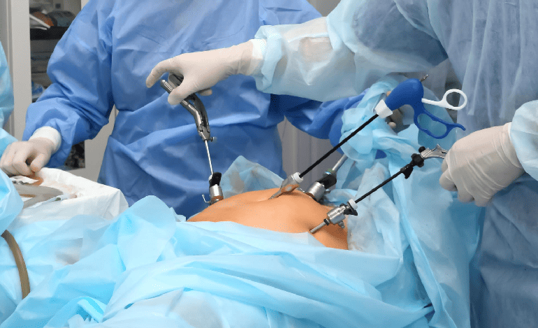 Cirugía Endoscopica Ginecológica