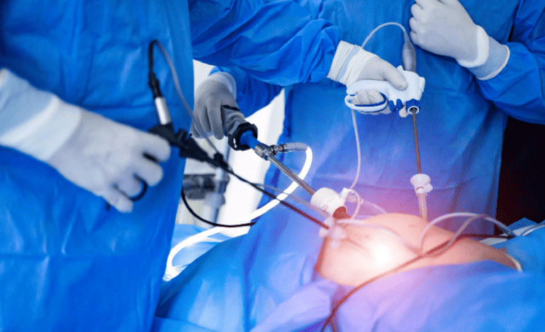 Histerectomía en CDMX: Innovación en Uroginecología, Ginecología y Obstetricia