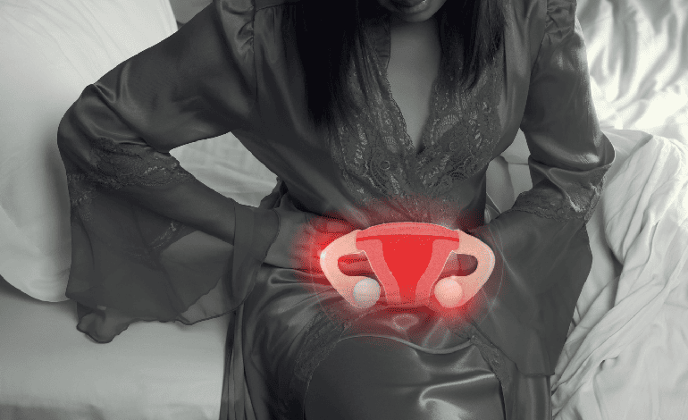 Descubre Tratamiento Integral de Endometriosis en CDMX: Innovación en el Cuidado Femenino